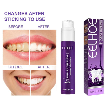 Teeth Cleaner SparklePro™ – Brighten Your Smile Effortlessly! 😁✨