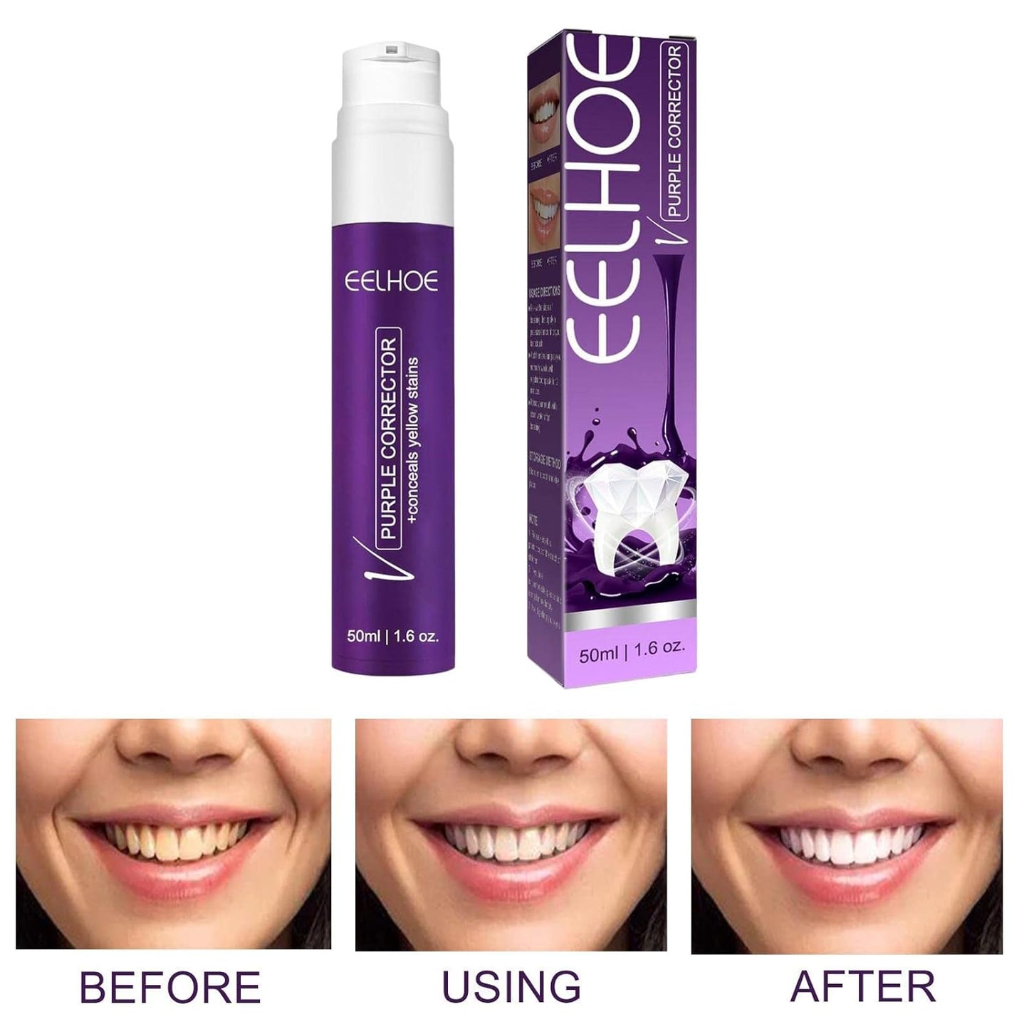 Teeth Cleaner SparklePro™ – Brighten Your Smile Effortlessly! 😁✨